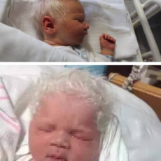 Bambino nasce con i capelli bianchi