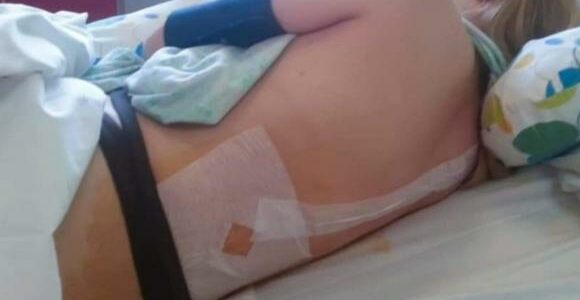 URLA E DIVENTA ROSSA DI NOTTE, POI I MEDICI FANNO L’AGGHIACCIANTE SCOPERTA